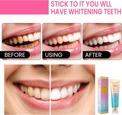 BodyAccel Niacinamide Whitening Toothpaste – Stain & Enamel Care, Fresh Mint