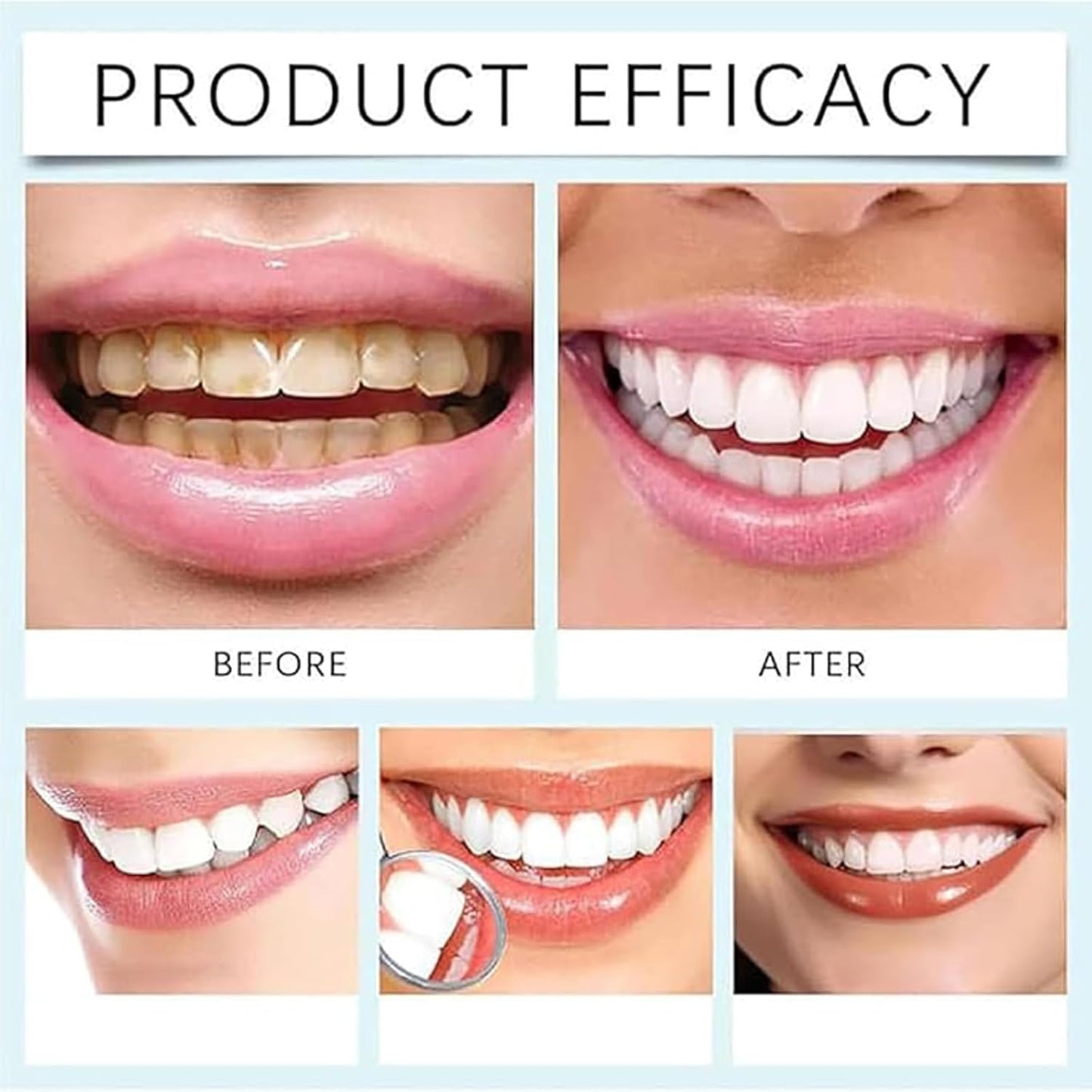 7.5% Nano Hydroxyapatite Fluoride Toothpaste for Teeth Whitening