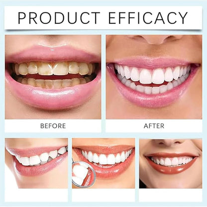 7.5% Nano Hydroxyapatite Fluoride Toothpaste for Teeth Whitening